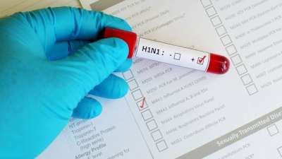 დადასტურდა, რომ აჭარაში 53 წლის პაციენტი H1N1 ვირუსით გარდაიცვალა