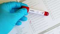 დადასტურდა, რომ აჭარაში 53 წლის პაციენტი H1N1 ვირუსით გარდაიცვალა