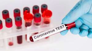 აზერბაიჯანში COVID-19-ით ინფიცირებულთა რაოდენობა 16 968-მდე გაიზარდა